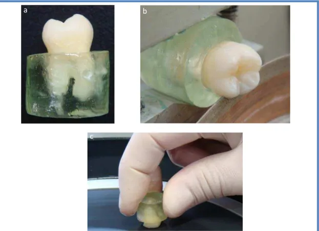 Figura 3: Imagens demonstram o preparo do dente: (a) inclusão,( b) corte da superfície  oclusal e (c) lixamento para exposição de dentina profunda 