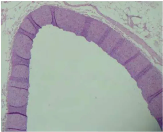 Figura 4. Determinação planimétrica das placas de ateroma e artérias de coelhos  – Tratamento  A