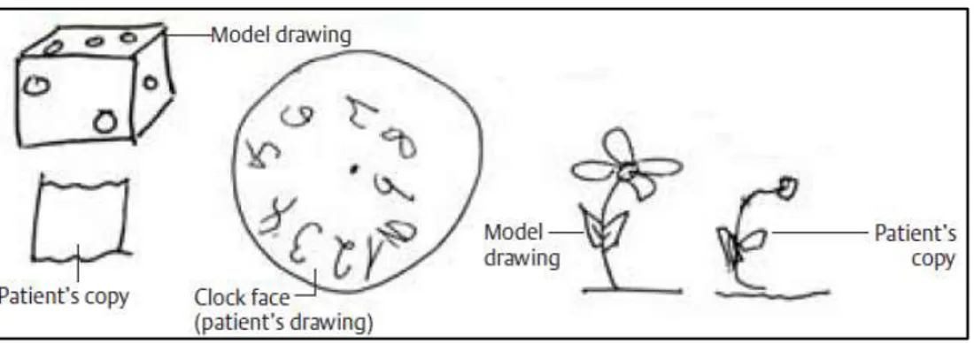 Figura 3: Alterações das capacidades visual e espacial  