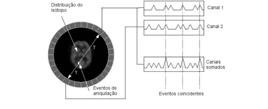 Figura 1.1: Diagrama b´ asico de um ”scanner” de PET ilustrando-se a coincidˆ encia de eventos em dois detectores