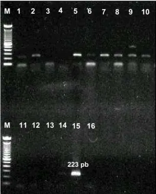 Figura 12 - Detecção de produtos amplificados das amostras com embriões infectados e        controle  M  M  223 pb M 1234567 8 9 1011 12 13 14 15 16M 223 pb M 
