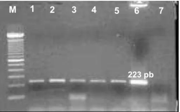 Figura 13 - Detecção de produtos amplificados das amostras com embriões infectados 