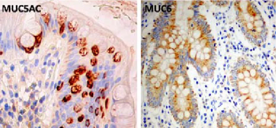 Figura 12 – Imunomarcação para os anticorpos anti-MUC5AC e MUC6 em células colunares  e células caliciformes.