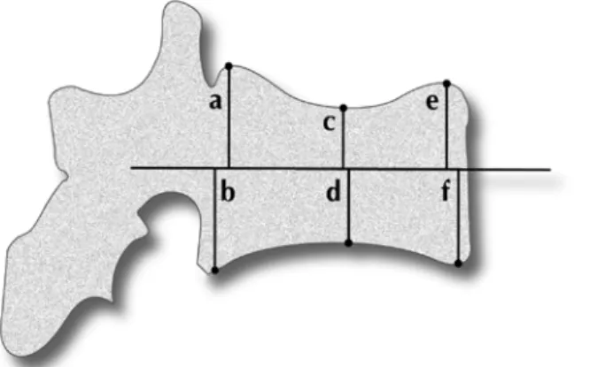 Figura 7 – Os 6 pontos da vértebra que são avaliados no VFA. 