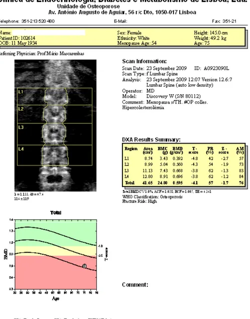 Figura 3- Exame da coluna lombar L1-L4, de uma mulher de 75 anos, com  T-score -4,1. Osteoporose