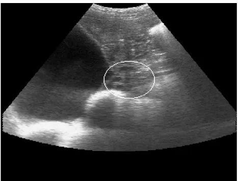 Foto 1 - Presença de folículos pré ovulatórios na área demarcada pela circunferência 