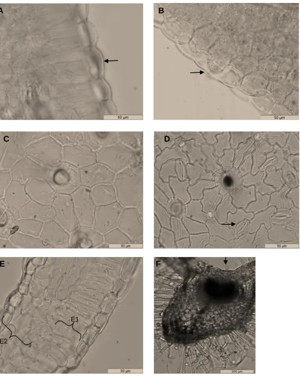 Figura  8  -  D.  purpurea  L.  (MO):  A  –  Cutícula  (seta)  da  página  superior  da  folha  em  corte  transversal  (barra  de  escala:  50  µm); B  – Cutícula (seta) da página inferior da folha em corte  transversal  (barra  de  escala:  50  µm);  C  