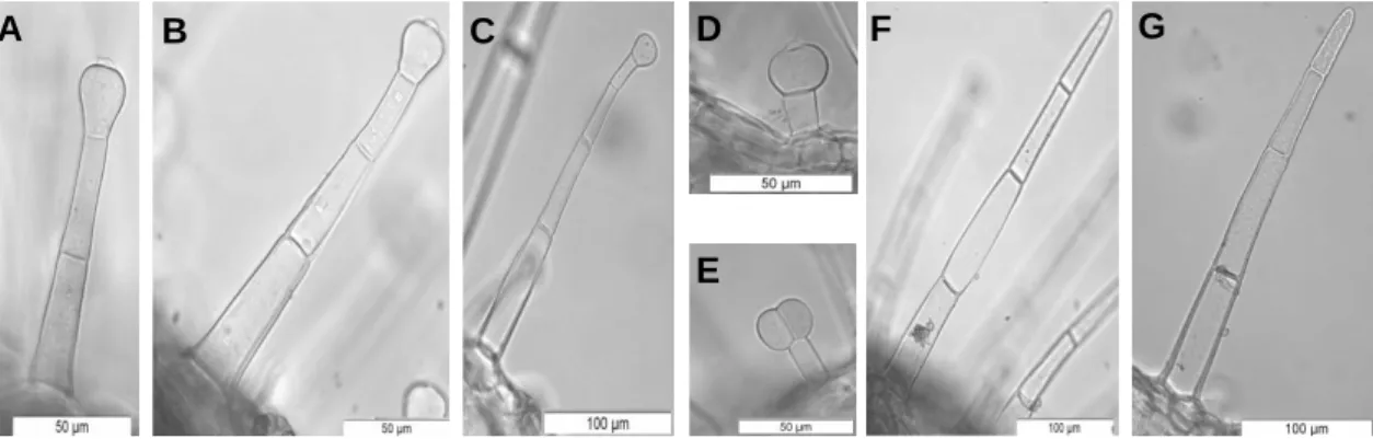 Figura  10  -  D.  purpurea  L.  (MEV):  A  –  Pormenor  da  superfície  da  epiderme  inferior  evidenciando tricomas secretores colapsados (seta) (barra de escala: 50 µm); B – Pormenor de  estoma anomocítico (barra de escala: 10 µm)