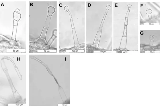Fig.  20  –  Híbrido  (MEV):  A  -  Pormenor  da  superfície  da  epiderme  inferior  evidenciando  tricomas  secretores  colapsados  (seta)  (barra  de  escala:  50µm);  B  -  Pormenor  de  estoma  anomocítico (barra de escala: 5µm)
