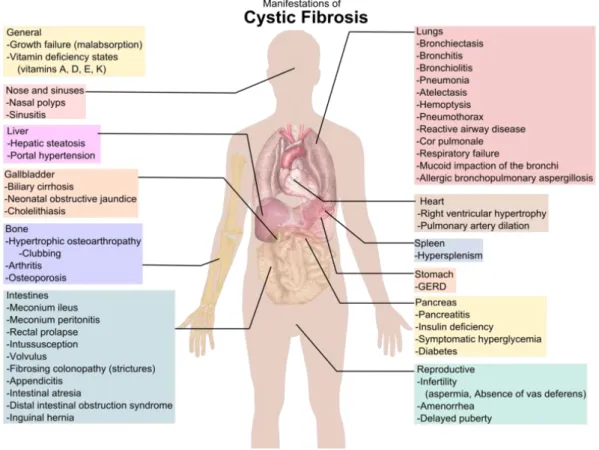 Figure  2  -  Phenotypic  features  consistent  with  a  diagnosis  of  CF.  Adapted  from: 