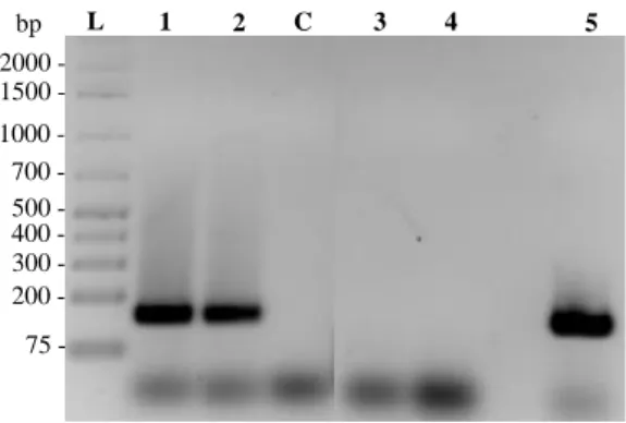 Figure 3.4 Detection by RT-PCR of the transcript obtained by 5’ 