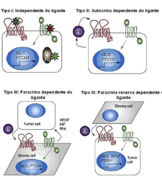 Figura 6: Três modelos de ativação da via do HH em câncer (Cohen, 2012).  