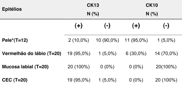 Tabela  5  -  Distribuição  da  expressão  das  citoqueratinas  13  (CK13)  e  10  (CK10)  nos  diferentes  epitélios  da  pele,  do  vermelhão  do  lábio  e  da  mucosa  labial  adjacente  aos  carcinomas  espinocelulares de lábio