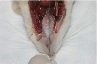 Figura 20 – Corte tangenciando a face distal do molar da hemimaxila direita 