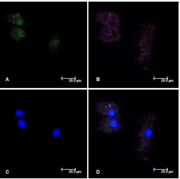 FIGURA  1.  Caracterização  da  população  celular  in  vitro.  Macrófagos  derivados  de  monócitos do sangue periférico de humanos apresentaram imunomarcação para CD14 (A) e  para  CD11c  (B)