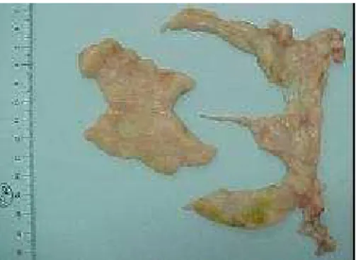 Figura 4 – Moela com a gordura aderida  Figura 5 – Placa de gordura abdominal (à  esquerda) mais gordura removida da moela 