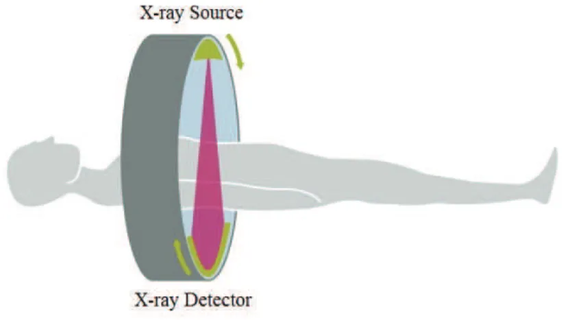Figure 2.2: The principle of computed tomography with an X-ray source and detector unit rotating synchronously around the patient [31].