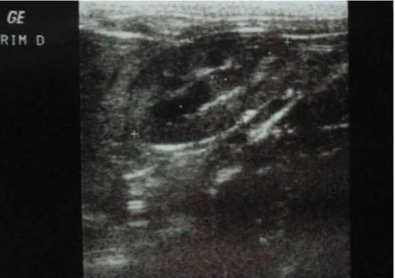 Figura 1 - Imagem ultra-sonográfica de corte sagital de rim direito de felino doméstico sem  alterações morfológicas, que permite dados métricos referentes ao comprimento e à altura 