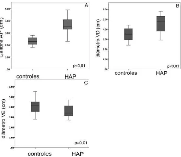 Figura  2  -  Comparação  entre  calibre  da  AP  (A),  diâmetros  do  VD  (B)  e  VE  (C)  entre  os  grupos HAP e controle