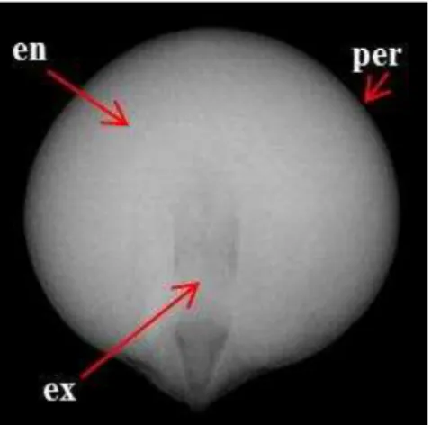 Figura 4 – Identificação das partes da semente de sorgo pelo teste de raios X: pericarpo (per), endosperma (en) e  eixo embrionário (ex) 
