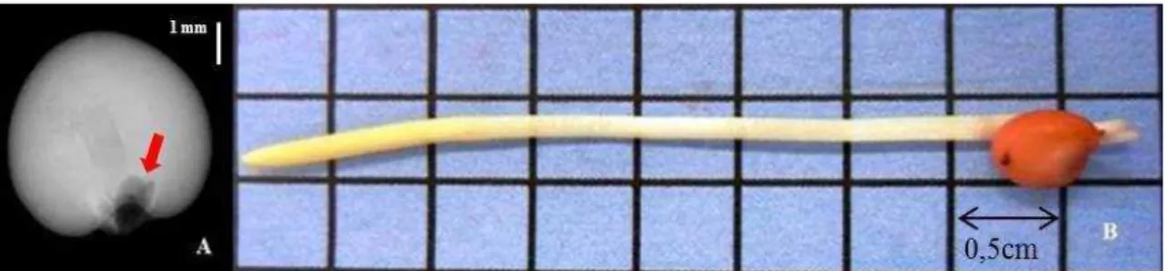 Figura 5 – Imagem radiográfica de semente de sorgo do híbrido 50A70, apresentando dano por deterioração  de  tecidos na região da radícula (A), originando uma plântula anormal (B) 