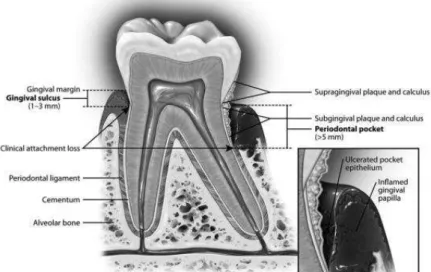 Figura 1- Anatomia periodontal na saúde e na doença. 