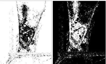 Figura 16 – Seleção (em preto) das áreas do tecido de granulação e de esfácelo, respectivamente 