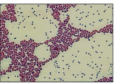 Figura 2. Lactococcus lactis ATCC 11454. 