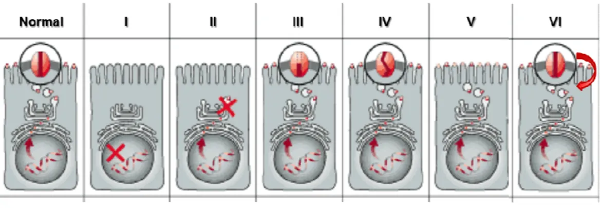Figure  I.2.2  –  Classes  of  CFTR  mutations.  (Normal)  CFTR  protein  in  the  plamas  membrane  of  cells  functioning  as  a  Cl-  channel;  (I)  class  I  mutation:  prevent  translation;  (II)  class  II:  defective  processing;  (III)  class  III:
