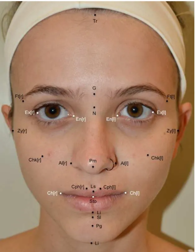 Figura  2  -  Aspecto  frontal  da  face  ilustrando  os  pontos  de  referência  ( landmarks )