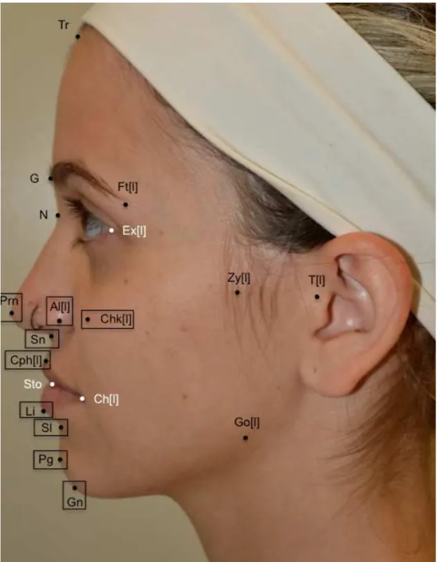 Figura 3 - Aspecto lateral da face ilustrando os pontos de referência. 