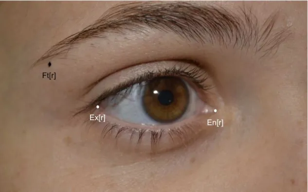 Figura 5 - Aspecto fronto-lateral detalhada dos pontos de referência nos cantos  interno e externo do olho