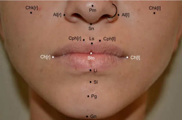Figura  6  -  Aspecto  frontal  aproximada  dos  pontos  de  referência  em  terço  inferior de face