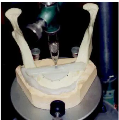 Figura 4.3 - Conjunto mandíbula/silicona fixos a uma base de gesso que permitiu  reprodutibilidade de posição 