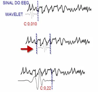 Figura 28. A wavelet vai correndo ao longo do sinal de EEG e calculado o C  (correlação)  até  o  final  do  sinal