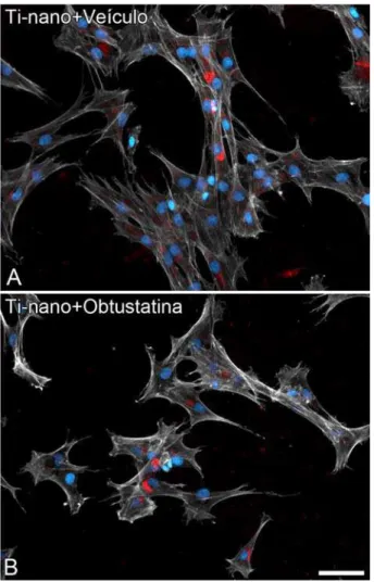 Figura 4. Epifluorescência de CTMs de ratos cultivadas em meio não osteogênico sobre superfície de Ti com  nanotopografia, tanto na presença do veículo (A) quanto de obtustatina (B), em 24 horas