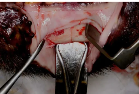 Figura 6: Utilização da pinça cremalheira em base mandibular para melhor redução e estabilização dos  segmentos ósseos