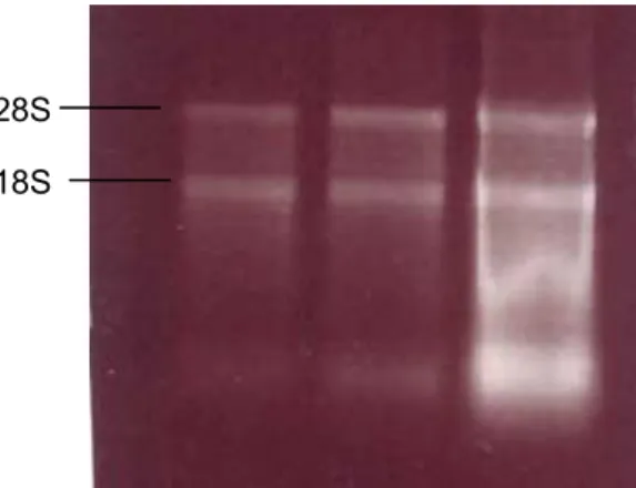 Figura 10. Gel de agarose 1% mostrando a integridade da extração de RNA em amostras de pele  genital de 3 pacientes