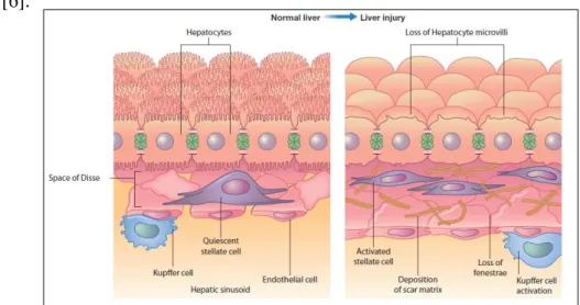 Figure 1.2. Hepatic liver cells in a normal and injured liver. On the left is shown the normal liver cells,  the stellate cells are situated in the subendothelial space of Disse; on the right is shown the liver cells after  injury, and the effects are visi