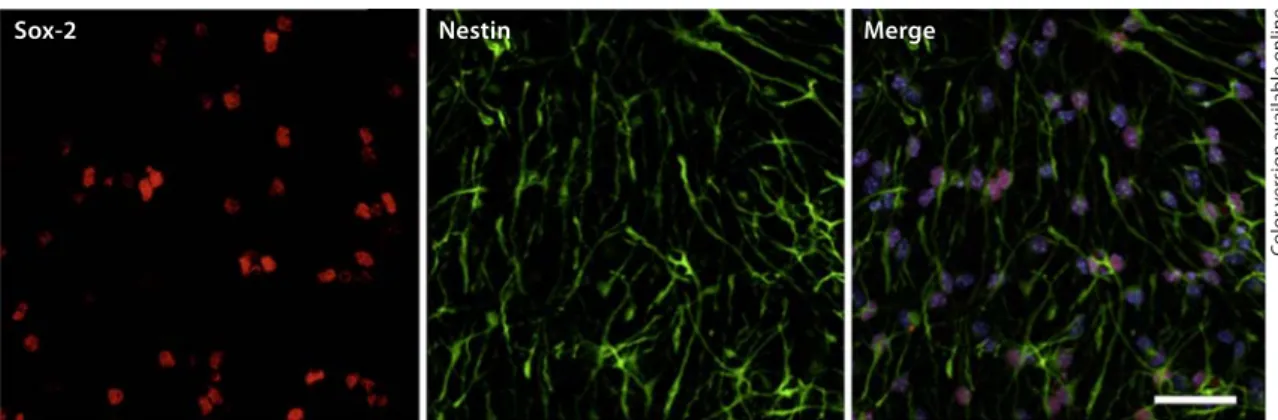 Fig. 1.   Characterization of SVZ stem cell cultures. Representative laser scanning confocal images of SVZ cells  labeled against Sox-2 (red) and nestin (green) are shown