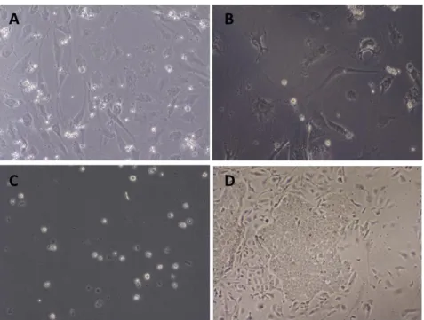 Figure 2.2 Differentiation of hESCs into DA neurons after ANL overexpression. (A) Negative control seeded on PA6