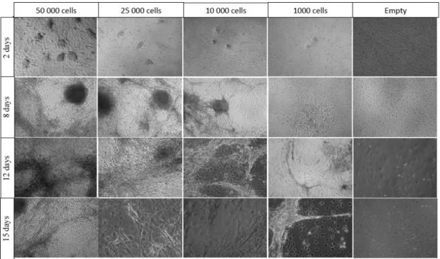 Figure 3.4 Differentiation of hESc on PA6 for 15 days. In this experiment, several cell densities were tested (50 000,  25 000, 10 000 and 1000)