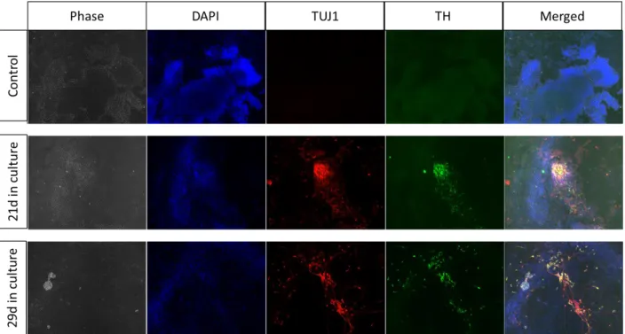 Figure 3.7 Analysis by immunofluorescence of differentiated cells. Both cell cultures (21d and 29d) were marked for neuronal  markers (TUJ1 and TH)