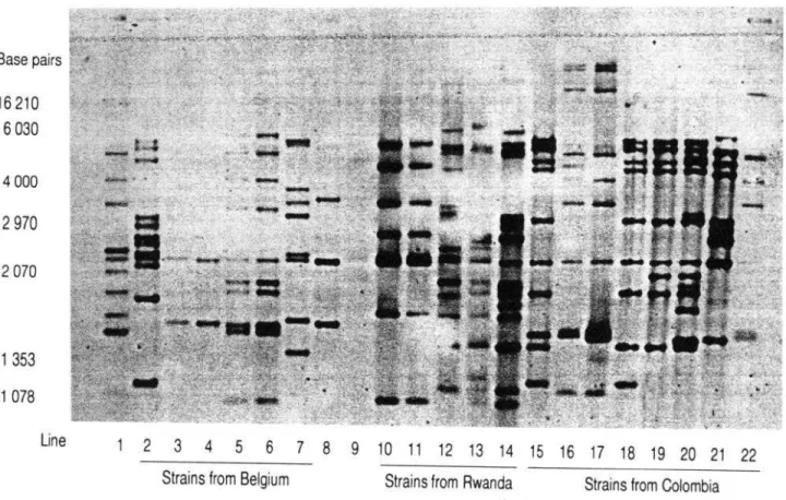 Figure  1.  Autoradiograph  of  size  polymorphisms  (in  base  pairs)  of  insertion  sequence  6110  in  19  strains  of  Mycobacterium  tuberculosis  from  Belgium,  Colombia,  and  Rwanda;  1  reference  strain  of  M