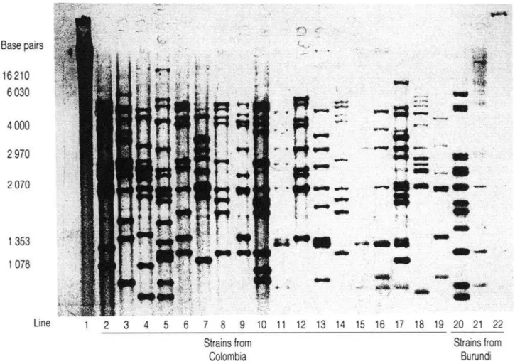 Figure  2.  Autoradiograph  of  size  polymorphisms  (in  base  pairs)  of  insertion  sequence  6110  in  1  reference  strain  of  Mycobacterium  tuberculosis  (strain  Mt  14323,  no  bands  visible),  18  strains  from  Colombia,  and  3  from  Burundi