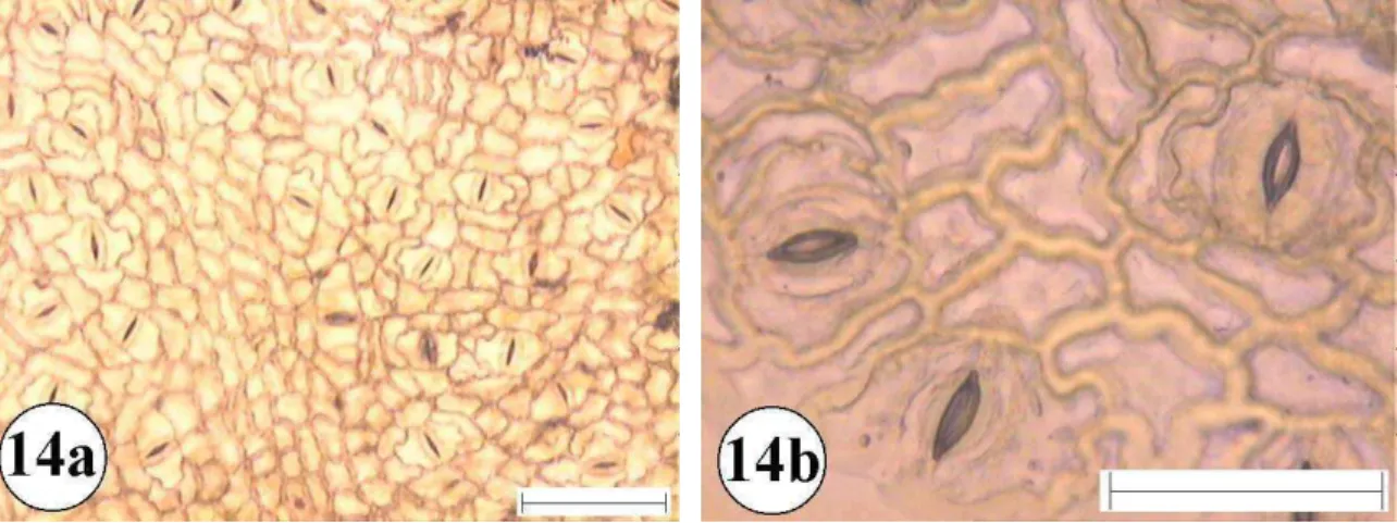 Figura 14:Epiderme foliar de: Pera glabrata  14a e 14b superfície abaxial  com aumento de 10 e 40 vezes respectivamente