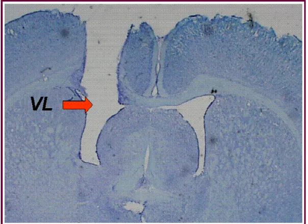 Figura 1.  Fotomicrografia de um corte histológico do cérebro de um animal,  indicando (seta) o local de injeção no ventrículo lateral (VL)