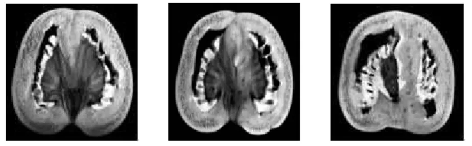 FIGURA 4.3 – Imagens originais de tomografia de ressonância magnética de um tomate. 
