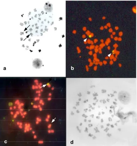 Figura 4: a) Metáfase mostrando os cromossomos portadores de RON através da impregnação por nitrato de prata; b, c) FISH com sonda de DNAr 18S mostrando somente um par de cromossomos portador de RON e diferença de tamanho das RONs; d) Metáfase mostrando bl