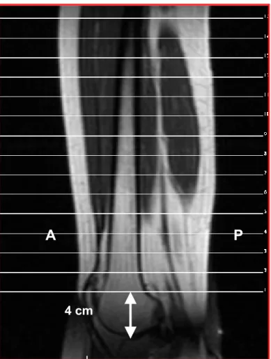 Figura 8- Exemplo de uma imagem localizadora sagital demonstrando as  secções através dos músculos da coxa